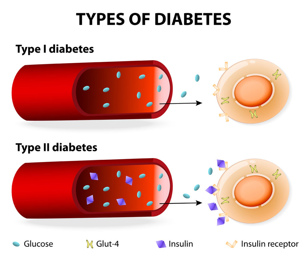 Diabetes Mellitus Homeopathic Treatment Consultation Online Gurgaon 